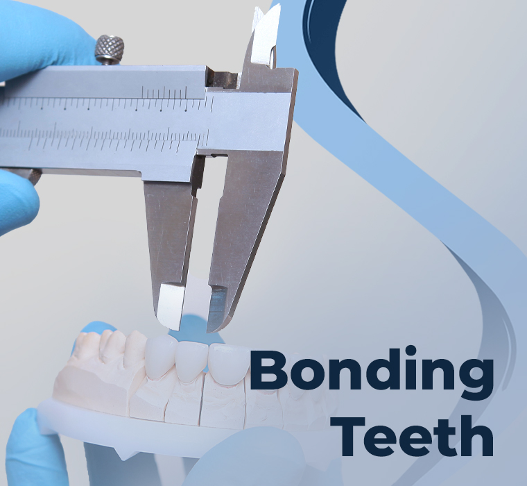 Bonding Tooth